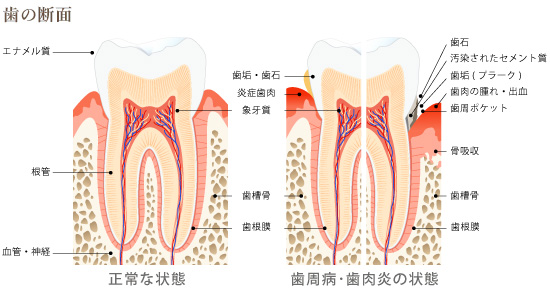 歯の断面